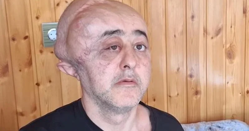 Bu vəziyyətdə 5 ay əlillik təyinatı ilə bağlı cavab gözləyib... Video