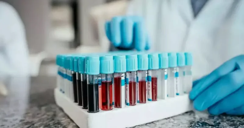 Qızıl qan : Dünyada cəmi 50 nəfərdə olan ən nadir qan qrupu niyə vacibdir?