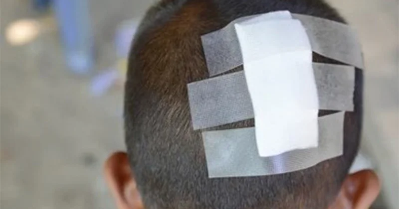 Hesaba görə kafe sahibi ilə mübahisədə 6 yaşlı oğlu başından zərbə aldı