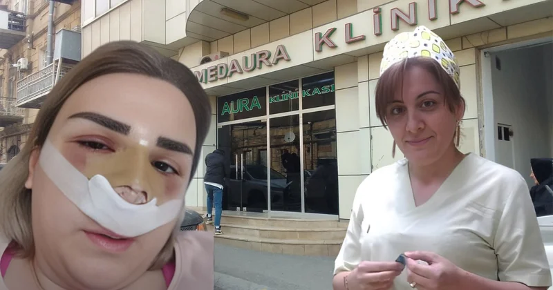 Ölüm saçan “MedAura” klinikası Uğursuz əməliyyatlara səbəb olan Nigar Məhəmmədova iş başındadır? ARAŞDIRMA