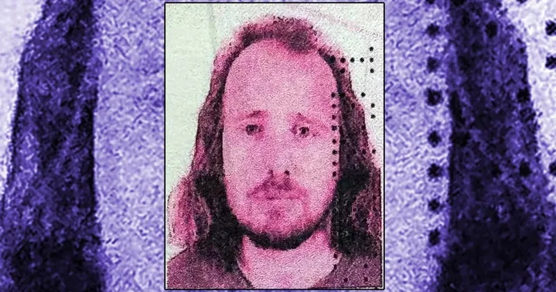 Saç əkdirib, dişlərini düzəltdirən ingilisin ölümü ilə bağlı istintaq başlanıb