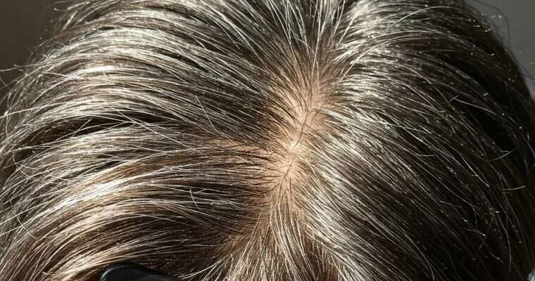 Saçlarımız bizi xərçəngdən qorumaq üçün ağarırmış