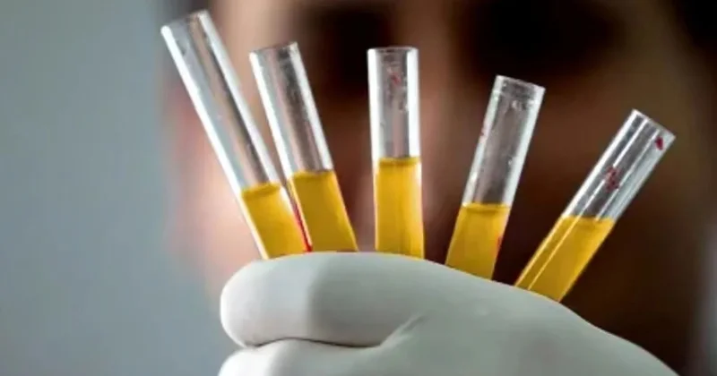 Dünyada cəmi 50 nəfər bu qana sahibdir