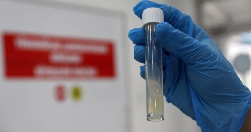 Dünyanın ən ölümcül yoluxucu xəstəliyi ÜST ün dəhşətli statistikası