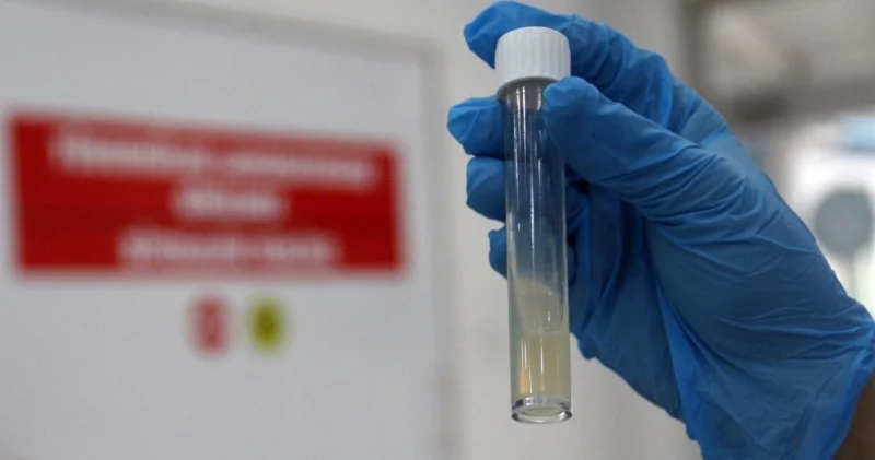 ÜST: Vərəm keçən il 1,23 milyon insanın ölümünə səbəb olub