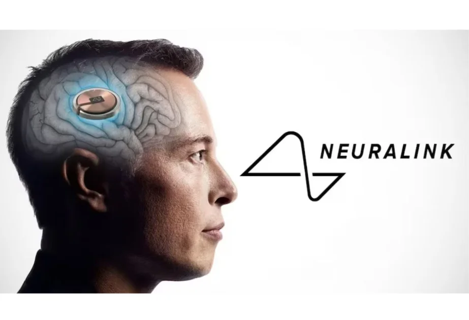 ABŞda Maskın “Neuralink” şirkətinə qarşı araşdırma başlayıb AZƏRTAC