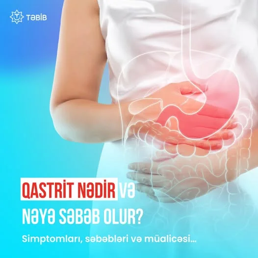 Qastrit nəyə səbəb olur? Müalicəsi necədir? HƏKİM ŞƏRHİ