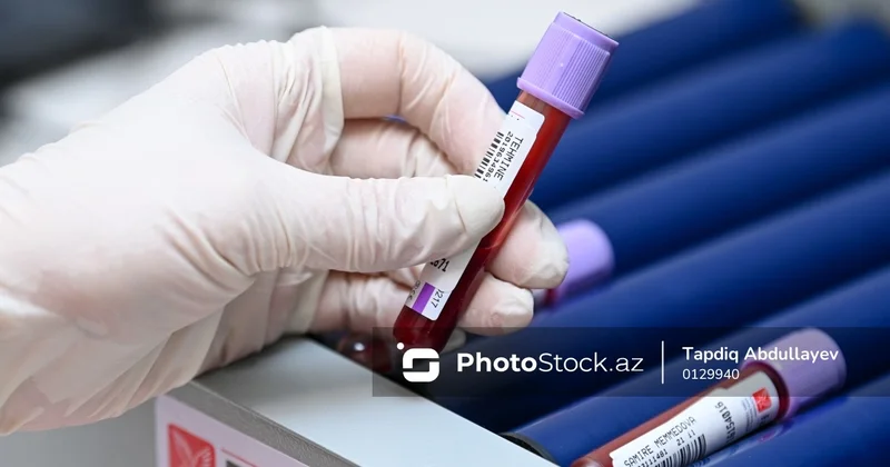 Səhiyyə Nazirliyinin mütəxəssisi: Üzün solğun olması yalnız qanazlığı demək deyil