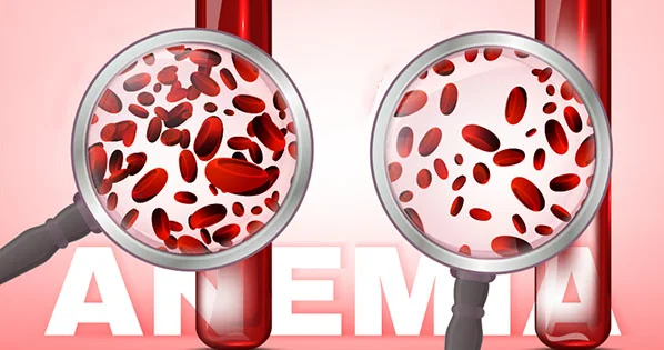 Qanazlığı nədən yaranır?