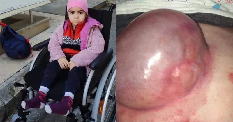 Ağır xəstəlikdən əziyyət çəkən Aminənin anası: Övladımın yaşaması üçün dəstəyə ehtiyacımız var