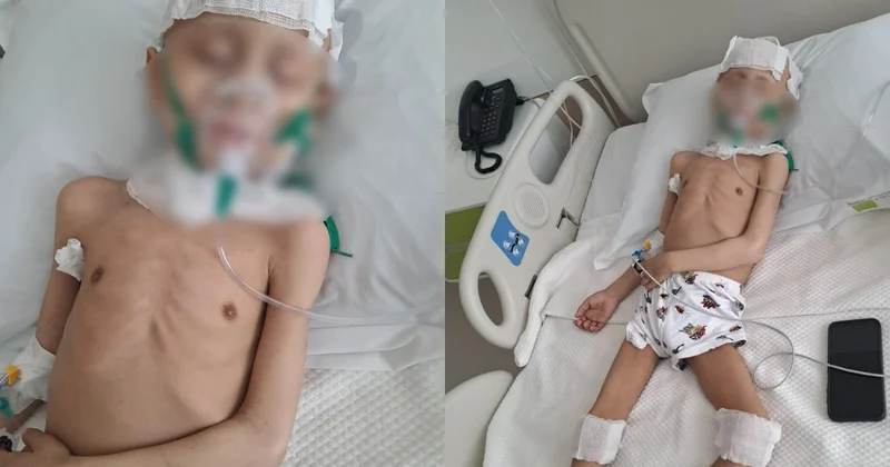 Xərçəngdən əziyyət çəkən dörd yaşlı İbrahim: Ana, kömək etsinlər, sağalım