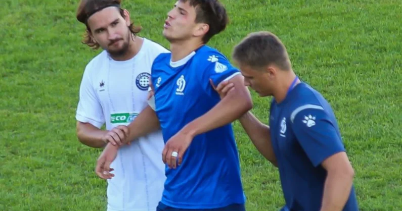 Rusiyalı futbolçu vurduğu qolu qeyd edərkən ciddi zədələnib
