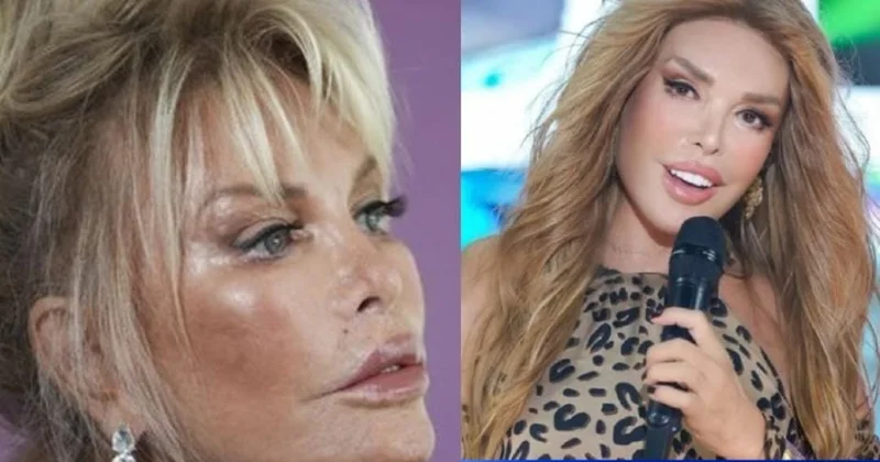 79 yaşlı Ajda Pekkandan üzgərmə əməliyyatından sonra ŞOK Fotolar