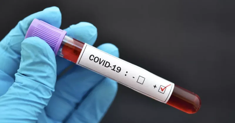 В Украине выявлены новые штаммы COVID 19