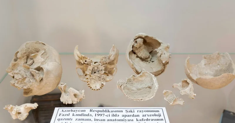 Azərbaycan Tibb Universitetinin Anatomiya Muzeyinin kolleksiyasından “çoxbaşlı dəfn”ə aid beş qədim kəllə