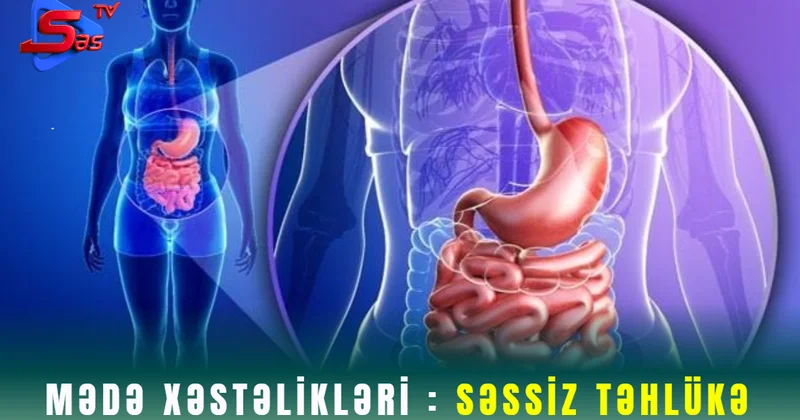 Mədə Xəstəlikləri : Səssiz Təhlükə