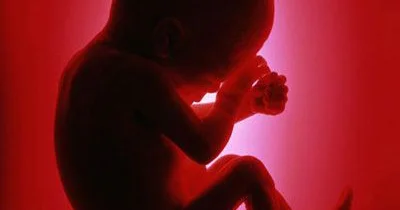 Süni abort (uşaqsalma)