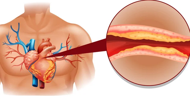 Xolesterin nədir? Növləri və orqanizmdə rolu