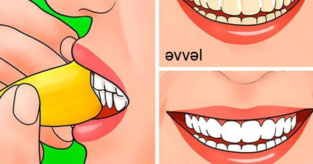 Banan qabığını sağlamlıq və gözəlliyiniz üçün belə istifadə edin