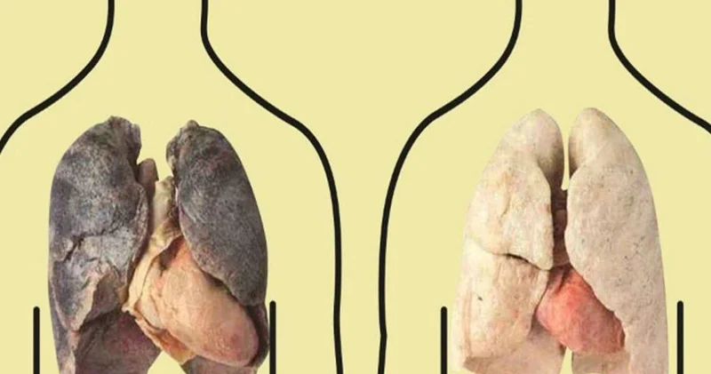 Ağciyərlərinizi təmizləməyin ƏN YAXŞI YOLU
