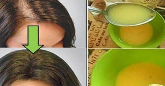 Saç tökülməsinə qarşı EFFEKTLİ MASKA
