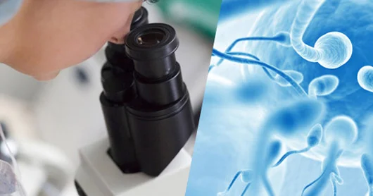 Spermoqramma kişi üçün ən mühüm və dəqiq məlumatlı müayinə