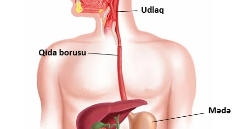 Udma zamanı çətinlik çəkirsiniz? Dərhal həkimə müraciət edin!