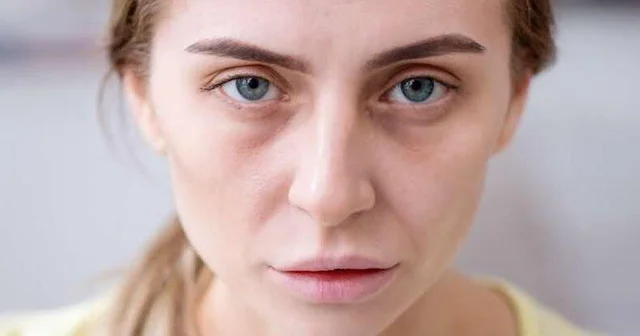 Soyuq aylarda bədənə ən çox hansı vitamin lazımdır Qanımız ondan asılıdır