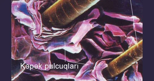 Kəpək niyə əmələ gəlir?