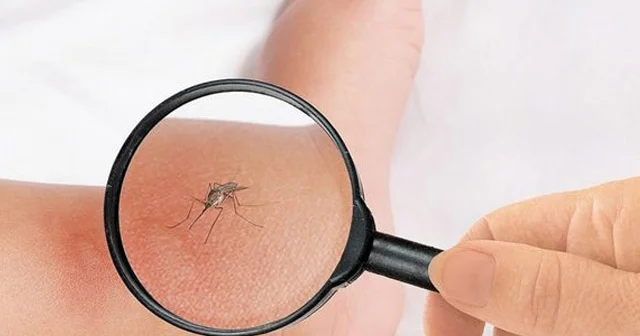 Ağcaqanad dişləyibsə... Qaşınma və şişkinliyi azaldan 7 sadə vasitə