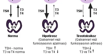 Qalxanvari vəzi fəaliyyətinin artması və onun simptomları
