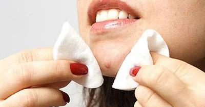 Sızanaqlara qarşı necə mübarizə aparmaq olar?