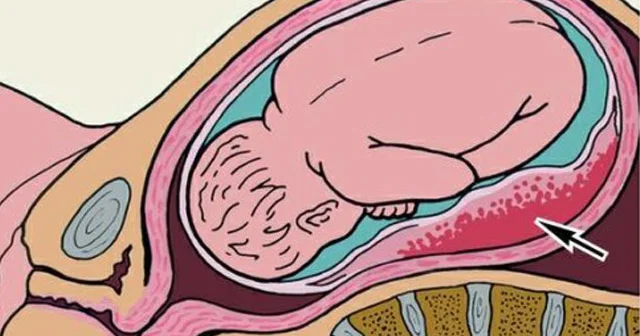 Cift nədir? Quruluş, funksiyalar, pozulmalar