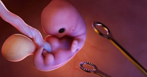 Abort ağırlaşması zamanı nələr baş verir?