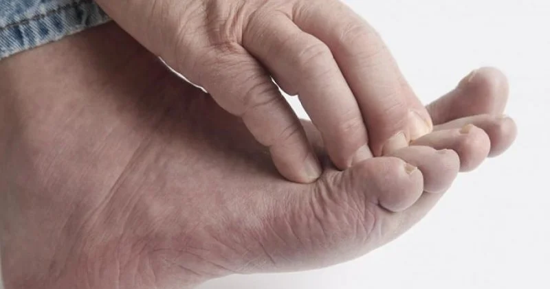 Diabetik ayaqlar amputasiyaya səbəb ola bilər Həkimdən vacib AÇIQLAMA