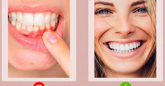 C vitamininin çatışmazlığına işarə edən 10 SİMPTOM