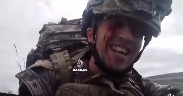 Gözündən yaralansa da, gülərək döyüşən zabit VİDEO