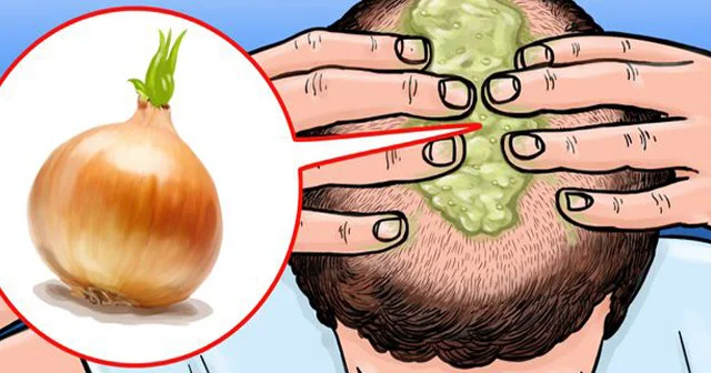 Saçların tökülməsini azaltmaq üçün 7 TÖVSİYƏ
