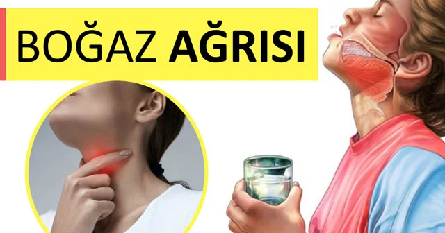Boğaz ağrısı zamanı xalq təbabəti üsulları VİDEO
