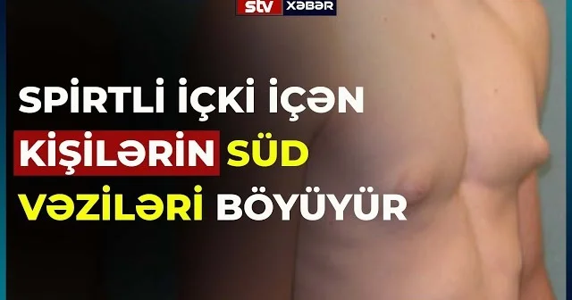 Spirtli içki içmək kişilərdə süd vəzilərini böyüdür Şok MƏLUMAT + VİDEO