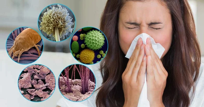 Allergiyadan qorunmaq üçün 6 SUPER QİDA