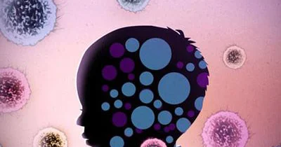 Fizioloji immunodefisit vəziyyətlər