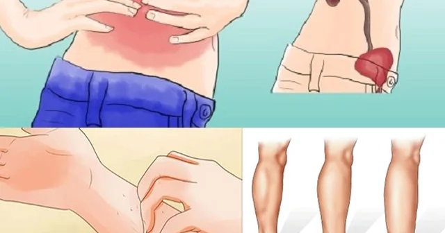 Böyrəkləriniz təhlükədədir! 13 gizli simptom