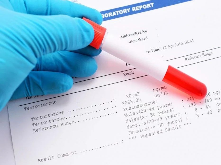 Qadınlar üçün ən vacib hormonal analizlər: TSH, T3, T4, prolaktin…