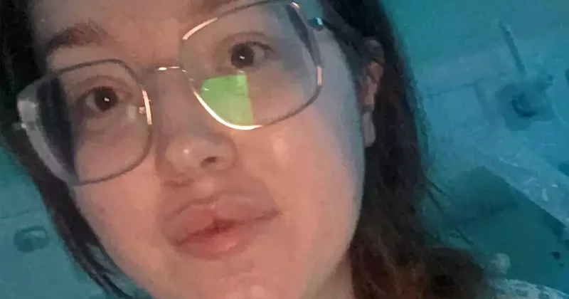 Женщина после свадьбы проснулась без зрения из за редкого диагноза