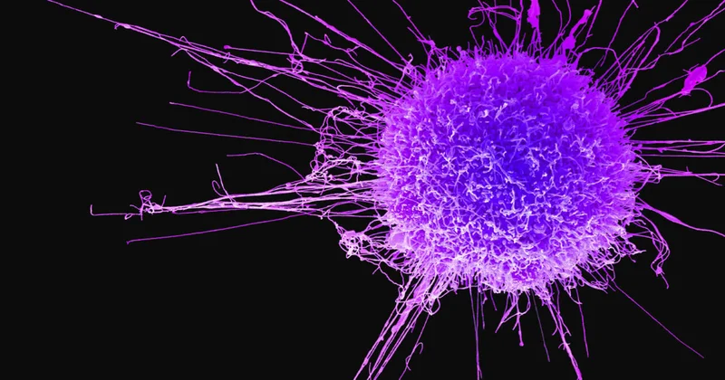 Bu qidalar bağırsaq xərçənginin düşmənidir