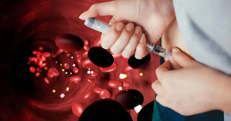 2050 yə qədər xəstə sayı 850 milyonu keçəcək Bu, epidemiya sayıla bilərmi?