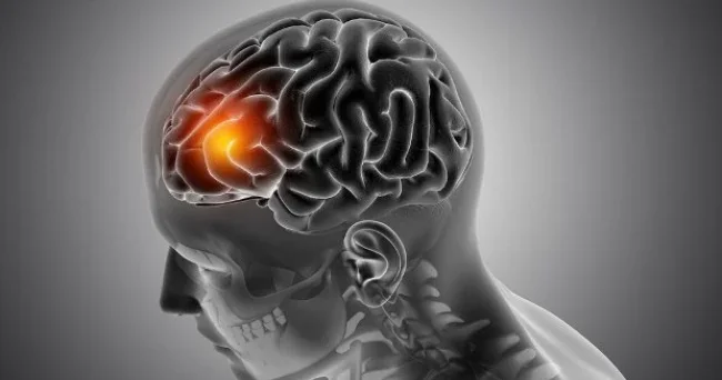 Beyin xərçəngdən necə qorunur?