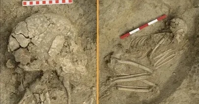 6200 illik skelet tapılıb:Şirin parçaladığı gənc necə sağ qalıb?