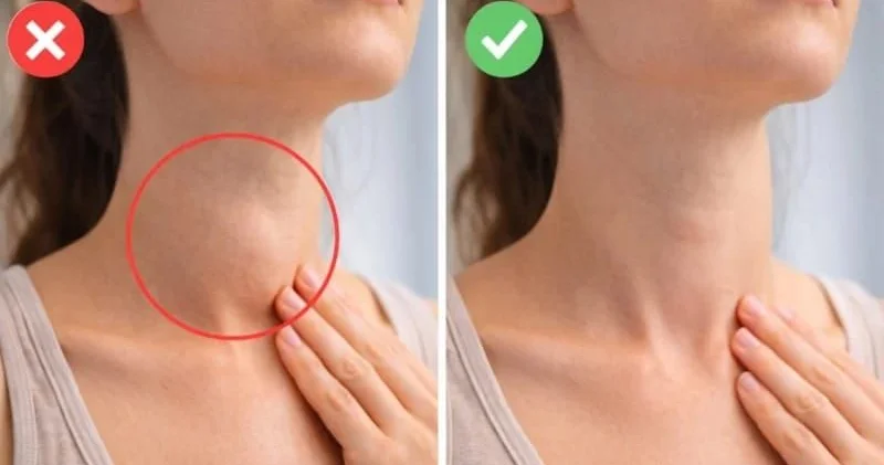 Evdə qalxanabənzər vəzinin müayinəsi: Güzgü qarşısında dayanın və yoxlayın